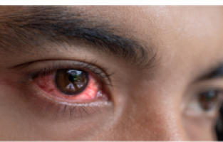 Vaka sayılarının patlaması sonrasında okullar tatil edildi