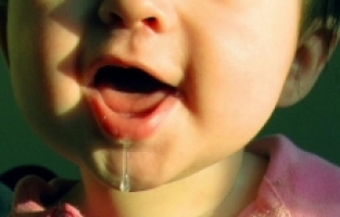 Çocuklarda salya akmasının nedeni geniz eti büyümesi!