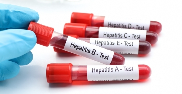 Tedavi Edilmeyen Hepatit Ölümcül Olabiliyor!