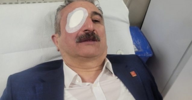 CHP İl Başkanı Nihat Yeşiltaş eylemde yaralandı